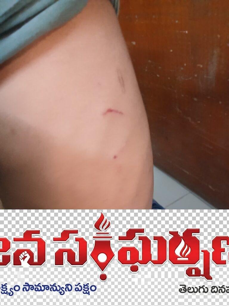 ఊటుపల్లి గ్రామంలో కోతుల బెడద.