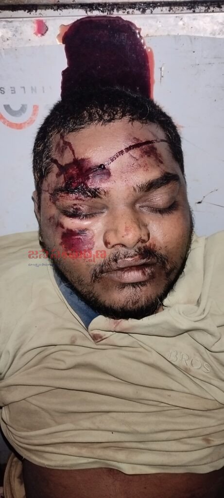 గురుకుల కాంట్రాక్ట్ టీచర్ రవి మృతిపై సమగ్ర విచారణ జరపాలి: బాధిత కుటుంబానికి తక్షణమే న్యాయం చేయాలని డిమాండ్.